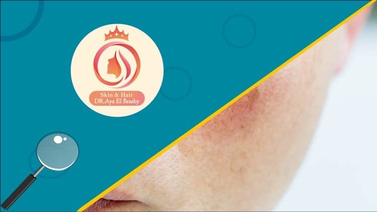 Mastering Sensitive and Damaged Skin: Science to Practice - Free Udemy Course