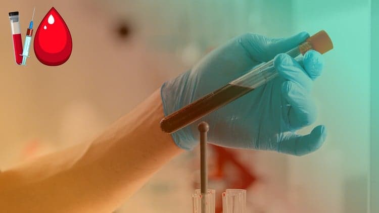 Phlebotomy Made Simple: Core Skills and Patient Care - Free Udemy Course